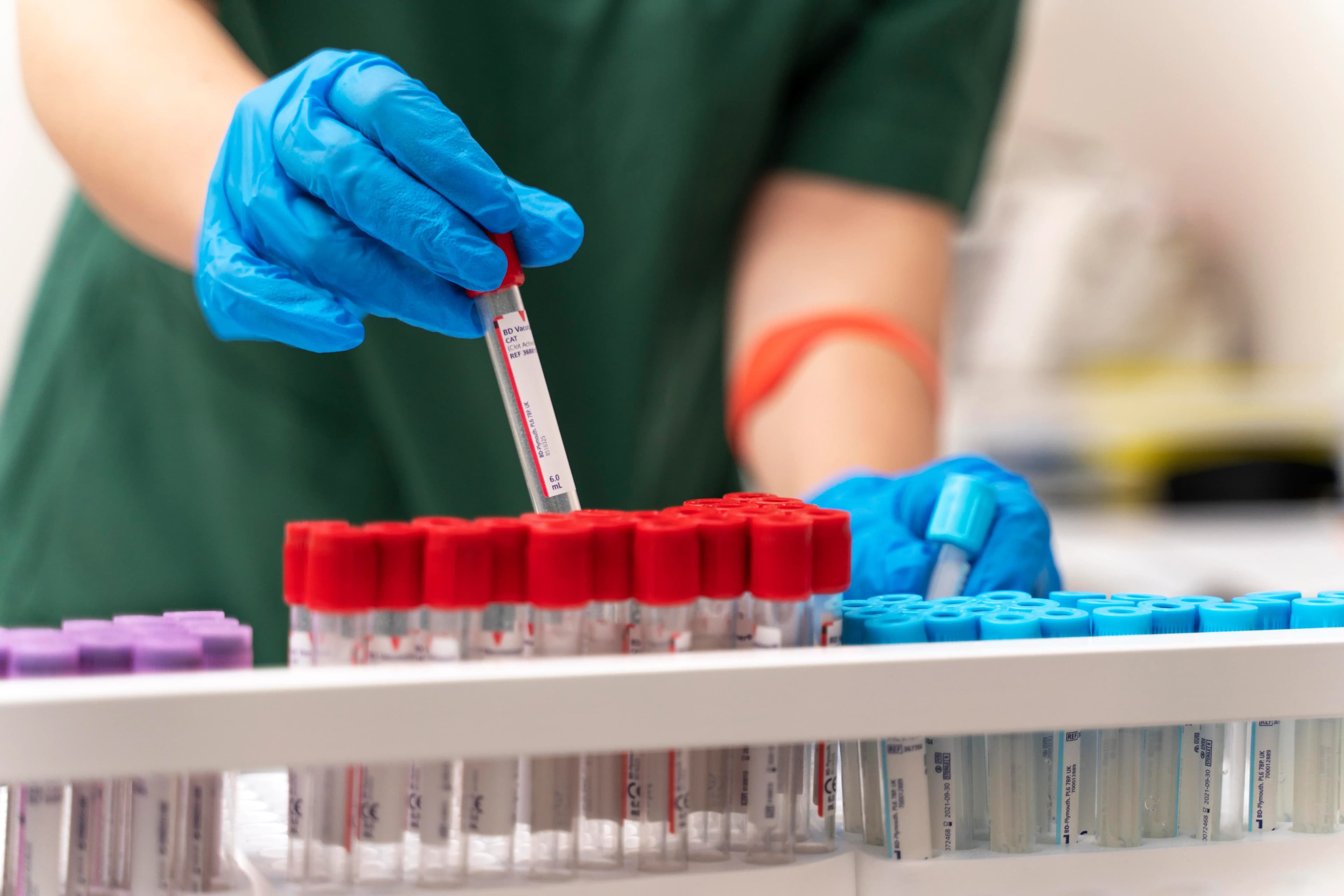 Scaling Blood Testing Operations with High-Capacity Plasma Separators